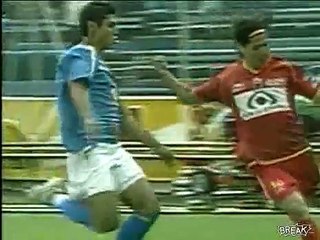 FOOTBALL PLAYER BREAKS LEG