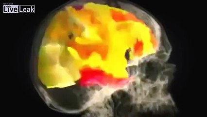 Female brain during orgasm