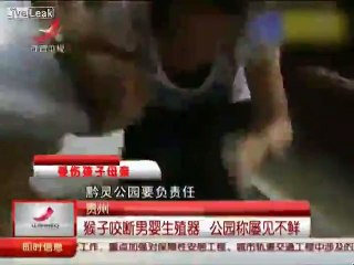 Mother cries after 8 mo son's penis was bitten off by monkey in park