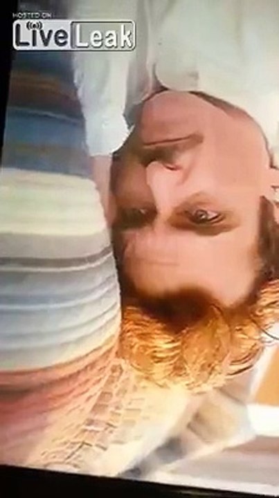 Joaquin Phoenix's forehead