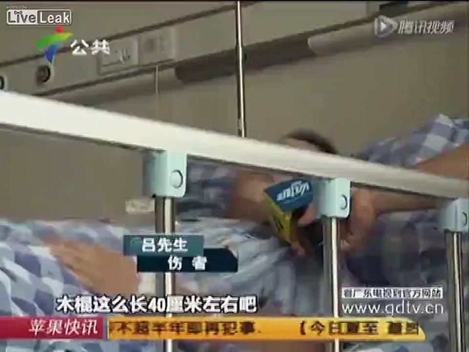 Man gets wooden spike 10 cm deep into anus