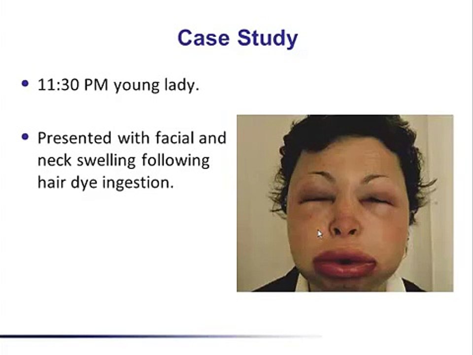 Lecture (2) A1-Asking clinical question (PICO format)