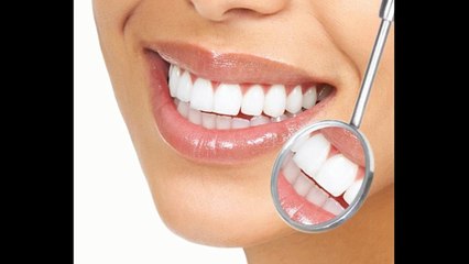 What are Dental Discount Plans