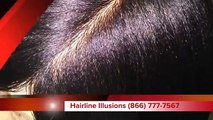 Relaxed Straight Cranial 'Scalp' Prosthesis by Egypt Lawson Hairline Illusions