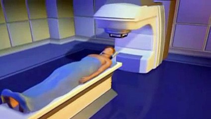 Cyberknife ®, la radiothérapie robotisée