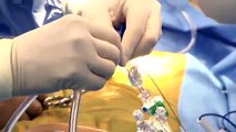 Allen Morris, MD - Robotic-Assisted Cardiac Surgery