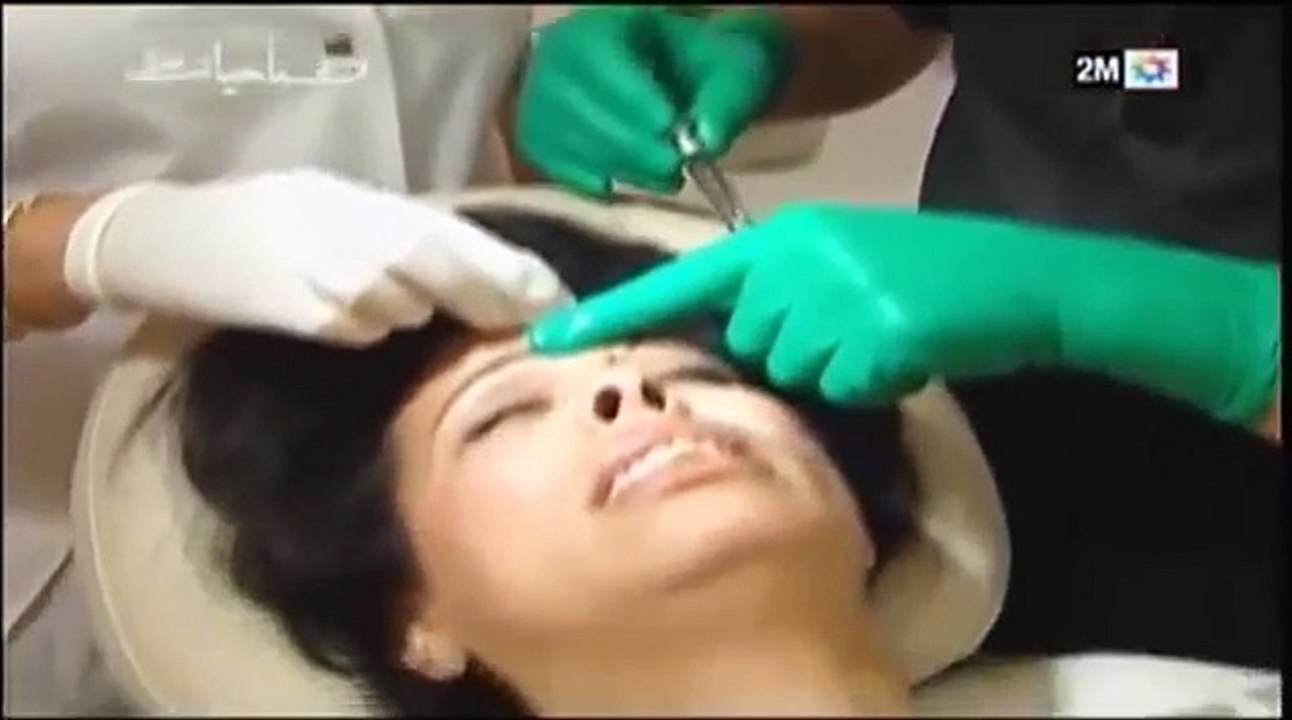 Guess Clinic Dr Guessous Mohamed الدكتور جسّوس, extrait Sabahiate sur injection acide hyaluronique