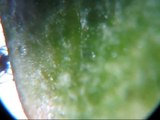 killer / predator mites vs. spider mites under the microscope