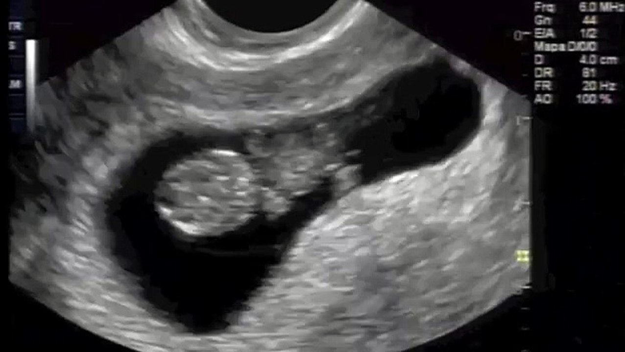 Baby First Rock Dancing