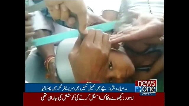 5-year-old child's head gets stuck in pressure cooker