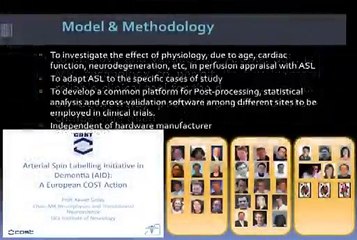 Arterial Spin Labeling in Elderly People and Neurodegenerative Diseases - Norberto Malpica
