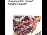 Is abortion right or wrong?