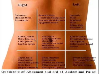 Comprehensive Guide to Abdominal Pain: Differential Diagnosis by Region 🩻 - thumbnail