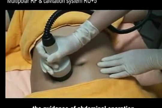 PORTABLE ULTRASONIC CAVITATION and RF MACHINE