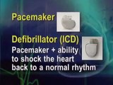 ICD Implantable Cardioverter Defibrillator
