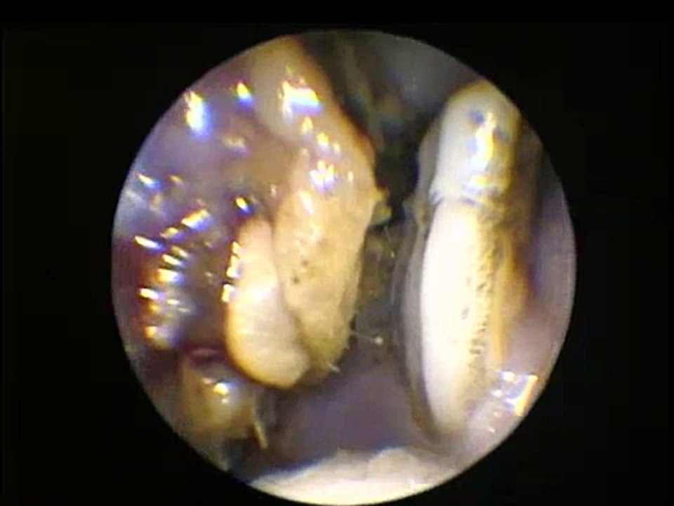 Einstein the Wonder Pig's teeth