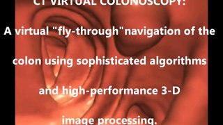 CT Virtual Colonoscopy @ First Scan