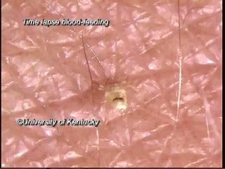 تبي تشوف الحشرة السامة التي تأخذ من دمك وأنت نائم على فراشك