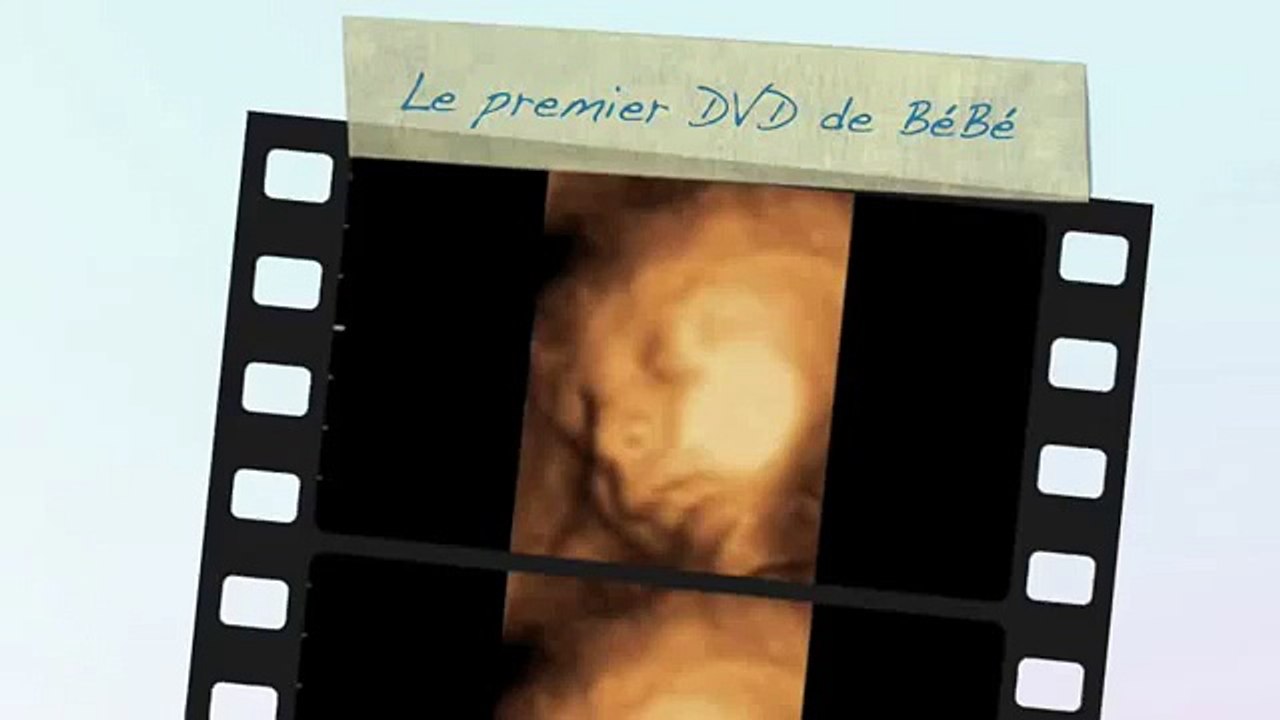 Echographie Souvenir 3d 4d Chez Baby Live Montpellier Video Dailymotion