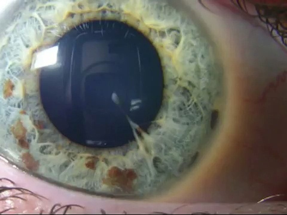 Tony Igy - Astronomia (Falling Star Remix) {HiM4nos Video Mix}