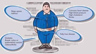 effects of obesity in children
