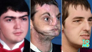 Face transplant recipient Richard Norris meets donor family that gave him a new life - TomoNews