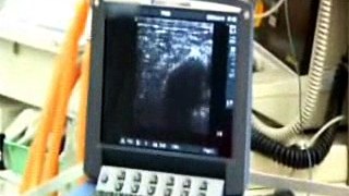 Ultrasound Use in Anaesthesia and Critical Care Medicine