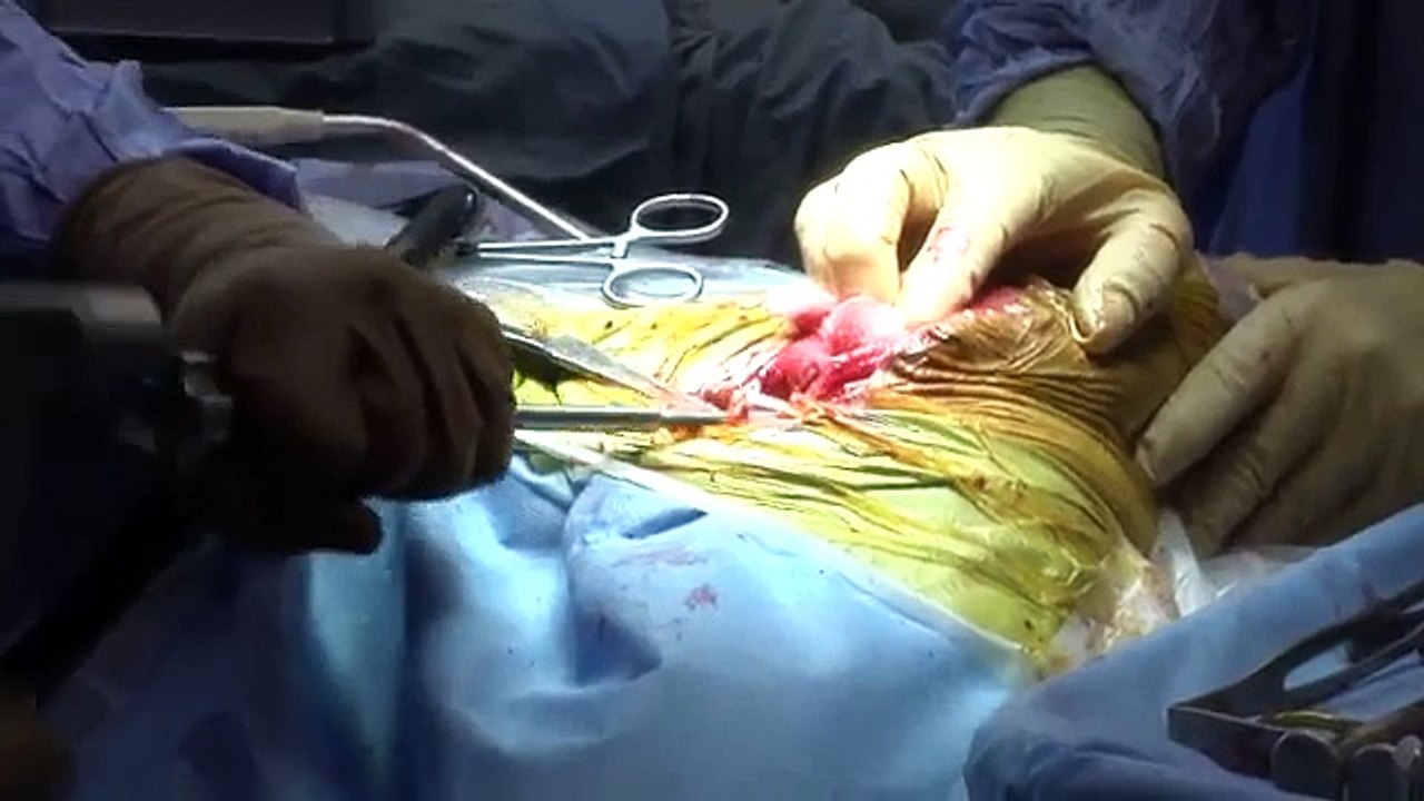 Total Hip Replacement - Snow Leopard "Panja"