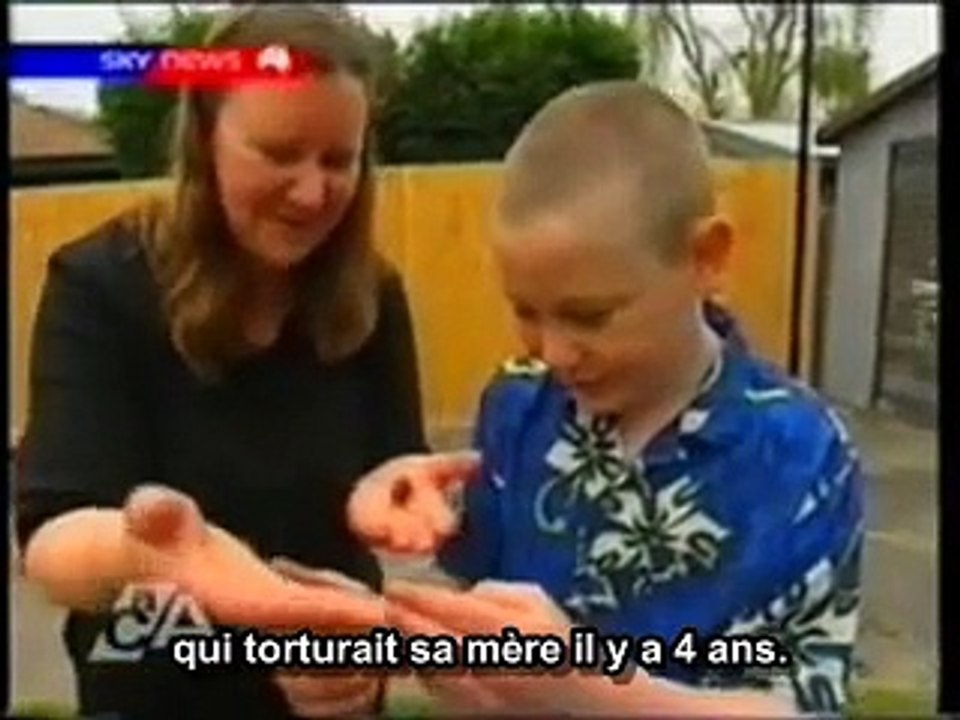 Le neurofeedback pour le TDAH sur Sky News TV
