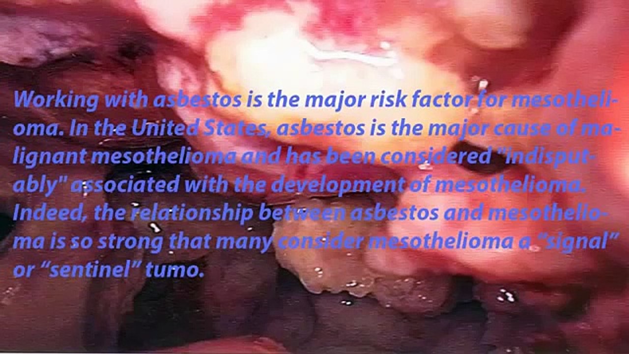 what causes squamous cell carcinoma in the throat