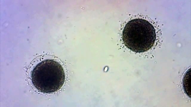 Fécondation in vitro de l'oursin
