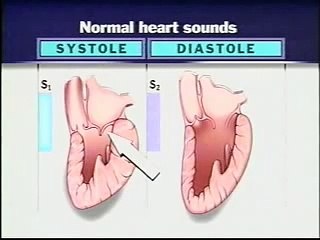Normal Heart Sounds