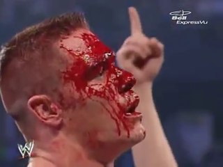 WWE Superstars Experienced Real Blood