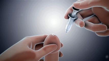 Modo de aplicación: instrucciones para el paciente al que se le ha prescrito Virirec.