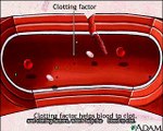Blood Clotting Process (Hemostasis)
