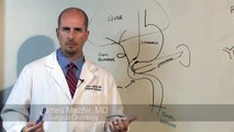 Whipple Procedure (Pancreaticoduodenectomy) - James Mezhir, MD