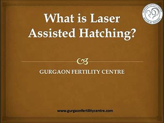 What is laser assisted hatching