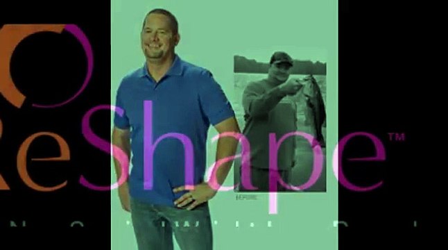 dual gastric stomach balloon weight loss