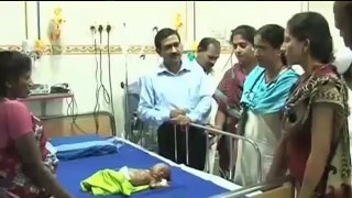 Un bebe de la India sufre combustiones espontaneas