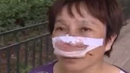 Shandong man bites off and eats wife's nose after she fails to answer his calls
