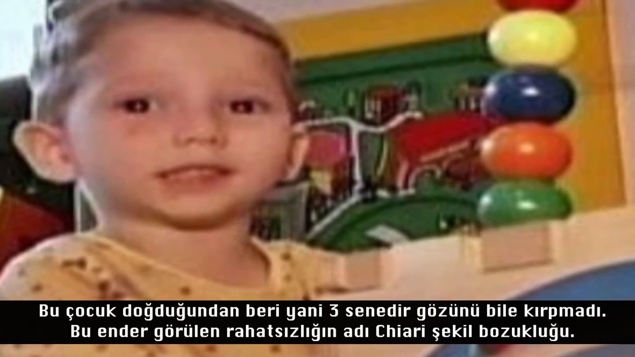 Dünyanın En İlginç Doğan 10 Bebeği (Çok Şaşıracaksınız)