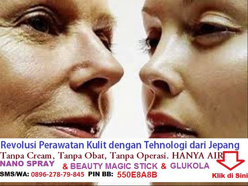 cara menghilangkan bekas jerawat ala orang korea