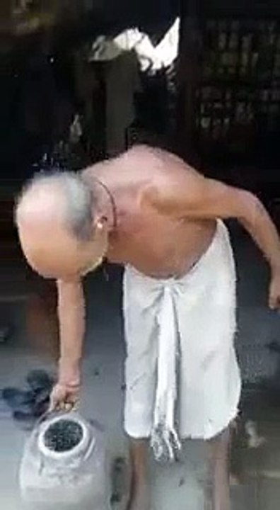 How this man manipulates his broken arm