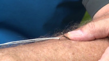 Total Outdoorsman: How to Remove a Fish Hook