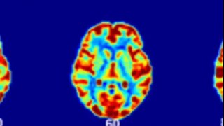 Can fMRI be used for Mind Reading?