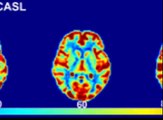 Can fMRI be used for Mind Reading?