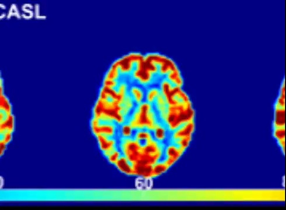Can fMRI be used for Mind Reading?