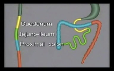 Embryology of the GI Tract (USMLE Tutorial)