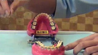 牙線穿引器的使用方式