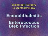 Endophthalmitis; Enterococcus Bleb Infection